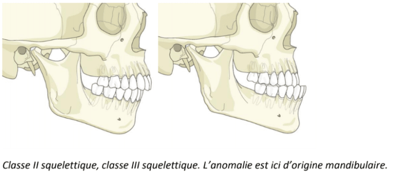 Quelles Sont Les Anomalies Du Menton Dr Chardain